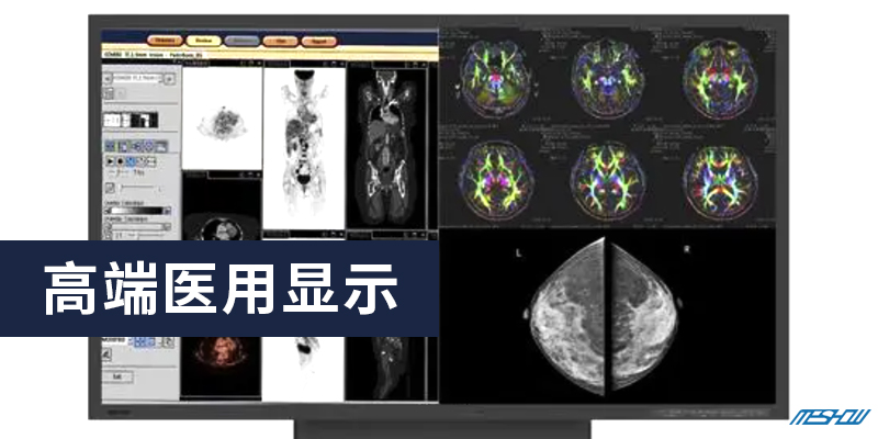 800 400高端医用显示.jpg